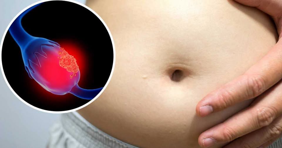 Cáncer de ovario en Chile: El desafío de un diagnóstico silencioso que afecta a miles de mujeres